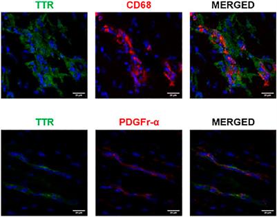 Cellular environment of TTR deposits in an animal model of ATTR—Cardiomyopathy